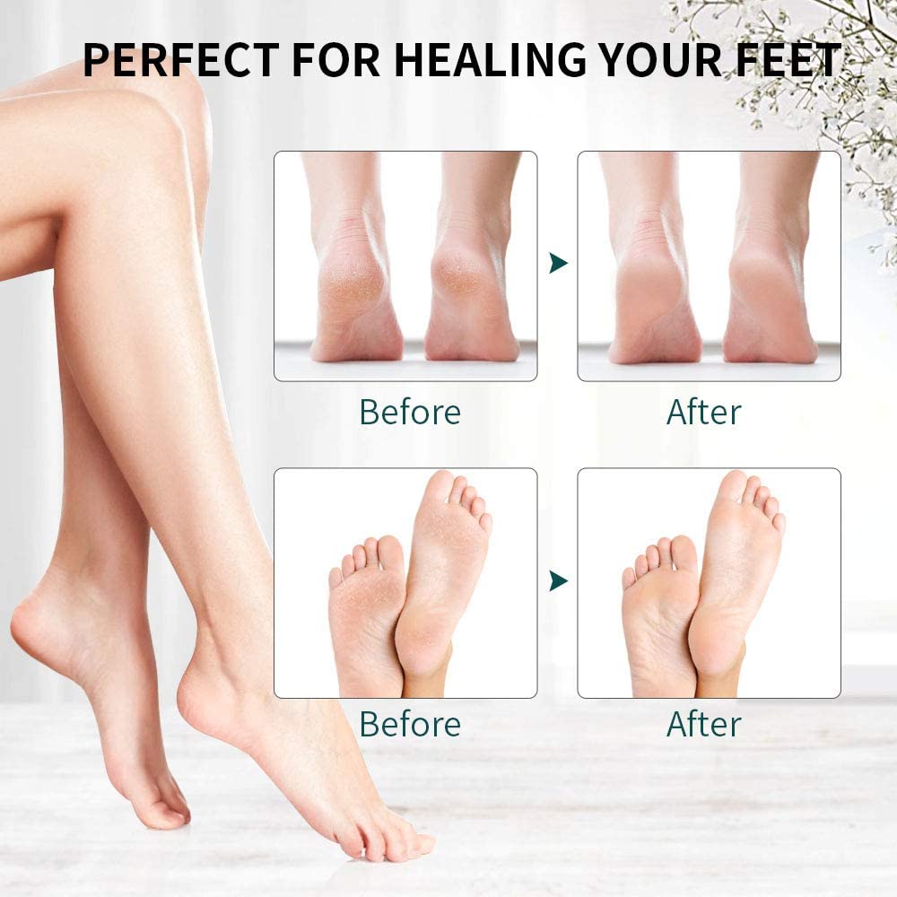 Electric Callus Remover, Rechargeable Electronic Feet File Hard Skin Remover